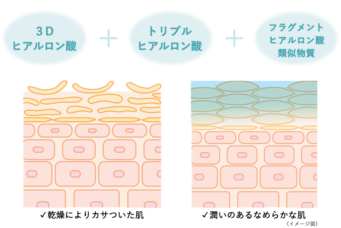 ヒアルロン酸複合体